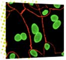 détection des mycoplames